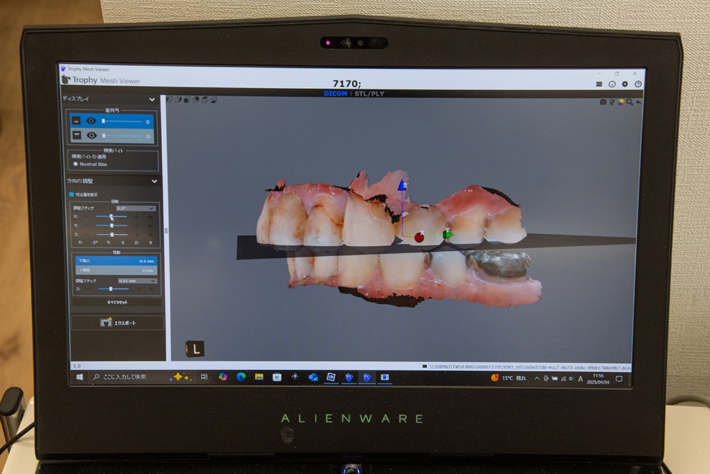 歯科用3Dスキャンビューア