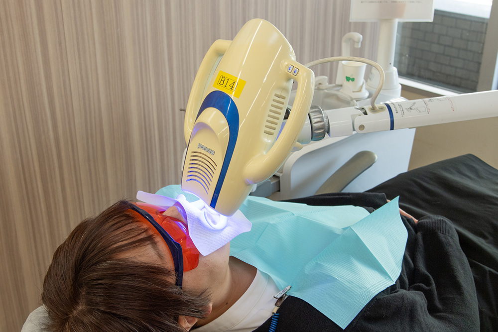 ホワイトニング専用照射器（Beyond POLUS）